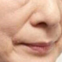 ˼ⷽ ʧ