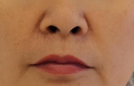 ���ܲ����ɿ���´��� ��Ƥ����3����������Ů��