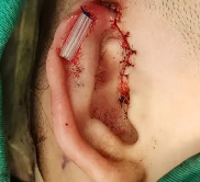 ��״�������������˯������ѹ