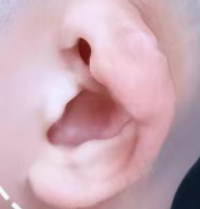 �������ҹ�ϵ���ı�״����һ��Ч����û�У���״���������Ѷȵ�������