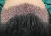 ���ͷ���ȷ���/����ֲ������/�����������ŷ�����