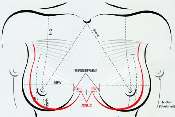 第二届"拯救乳房·挺胸做女人"选手见面会海峡整形医院拉开帷幕